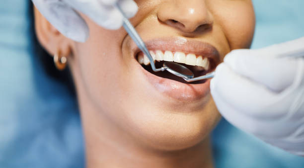 Best Emergency Denture Repair in West Columbia, SC